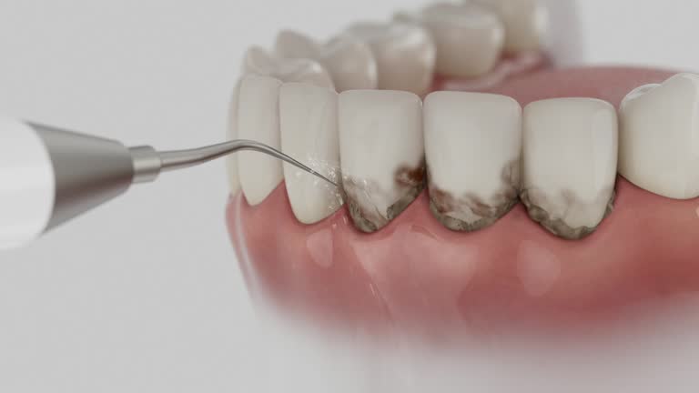 Reliable Dental contractor in Lock Haven, PA by Smile Center Dentistry